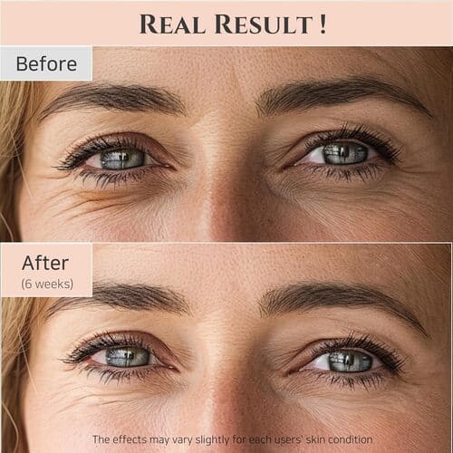 BEAUTY OF JOSEON Revive Eye Serum: Ginseng + Retinal 30ml - Image 5